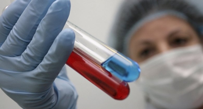 Борьба с ВИЧ и гепатитом. 2 млн. леев выделены на программы для Кишинева и Бельц