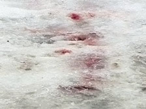 Бродячие собаки загрызли омскую школьницу