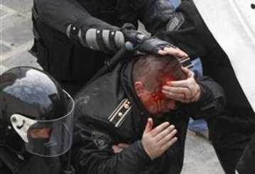 Михаил Лашку: 275 полицейских пострадали 7 апреля 2009 года, 54 из них нуждаються в медицинской помощи до сих пор